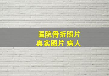 医院骨折照片真实图片 病人